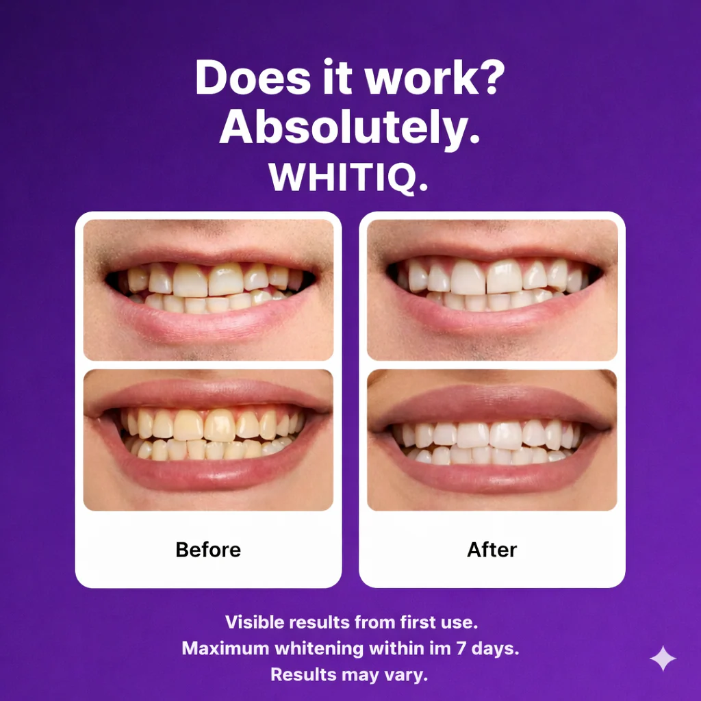 WHITIQ™ Color-Correct Whitening Strips - Image 3